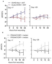Altered Serum Alpha1-Antitrypsin Protease Inhibition before and after  Clinical Hematopoietic Stem Cell Transplantation: Association with Risk for  Non-Relapse Mortality
