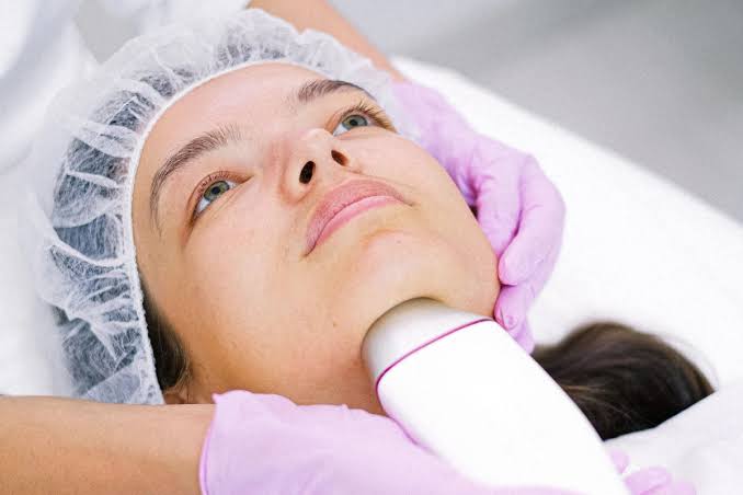 SmoothLase Facial Rejuvenation | The Wagner Centre