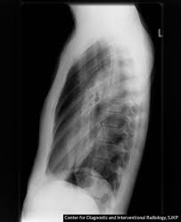 We did not find results for: Pneumothorax Knowledge Amboss