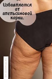 как убрать апельсиновую корку на лице в домашних условиях Izbavlyaemsya Ot Apelsinovoj Korki Beauty