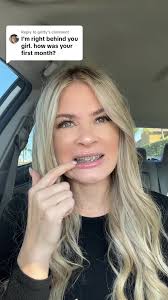 Madison Denise Braces