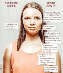 Hello good people, any home remedy to quit smoking