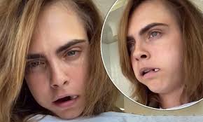 She does, however, enjoy experimenting with hair colors. Cara Delevingne Cries As She Has Her Wisdom Teeth Removed Daily Mail Online