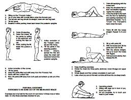 Get the facts on scoliosis types and symptoms. Exercise For Scoliosis S Curve Exercisewalls