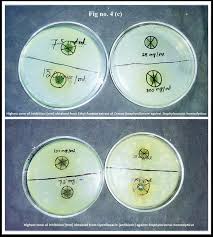 Image result for Croton steenkampianus