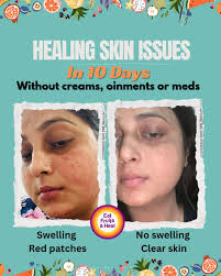 Introduction to the Eat Fruits and Heal Community