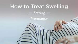 Swollen Hands During Pregnancy Natural Treatments