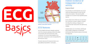 Instalar ecg simulator en su pc con windows o mac laptop / desktop, deberá descargar e instalar un emulador de android que puede descargar e instalar de . Ecg Basics Full On Windows Pc Download Free 2 0 0 Com Panacea Ecgbasicspro