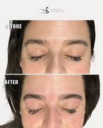 Advanced Aesthetics added a new...