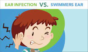 The best thing to do when water becomes trapped in your ear is to drain it, and there are a variety of techniques that can help you do so. Swimmer S Ear Vs Inner Ear Infection Four Ways To Spot The Difference