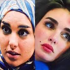 تطورات الحالة الصحية لـمتعب الحراس. ØµÙˆØ± ÙŠØ§Ø³Ù…ÙŠÙ† ØµØ¨Ø±ÙŠ Ù‚Ø¨Ù„ ÙˆØ¨Ø¹Ø¯ Ø§Ù„ØªØ¬Ù…ÙŠÙ„ Ù…Ø§ Ø§Ù„Ø¹Ù…Ù„ÙŠØ§Øª Ø§Ù„ØªÙŠ Ø®Ø¶Ø¹Øª Ù„Ù‡Ø§ Ù…Ø¬Ù„Ø© Ù‡ÙŠ