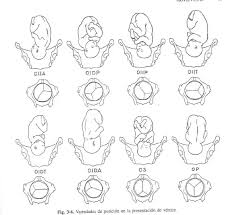 Maybe you would like to learn more about one of these? Why Don T Midwives And Doctors Use Endoscopes To Perform Internal Examinations During Labor Quora
