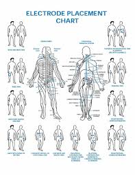 Electrode Placement Chart Tens Electrode Placement Tens Unit Placement Tens Electrodes