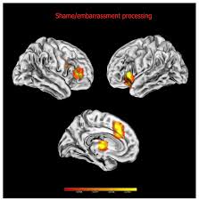 The Neural Signatures of Shame, Embarrassment, and Guilt: A Voxel-Based  Meta-Analysis on Functional Neuroimaging Studies