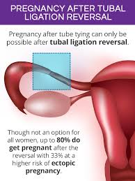 Chances Of Getting Pregnant After Tubal Ligation Shecares
