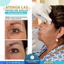 Cesar Calderon MD, Cirujano Plastico