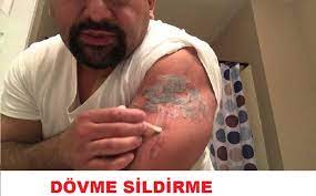 Dovme Sildirme Kiz Dovmeleri Dovme