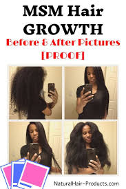 Black Hair Biotin Hair Growth Before And After Pictures Msm Hair Growth Before And After Pictures Proof Biotin Rice Water Diatomaceous Earth On Natural Hair D In 2020 Msm Hair Growth Thick Hair Styles Natural Hair Styles