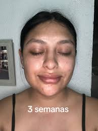 Serum Para Las Cejas The Ordinary