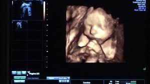 4d ultrasound pictures at 27 weeks. A 4d Ultrasound Of A Stock Footage Video 100 Royalty Free 7994203 Shutterstock