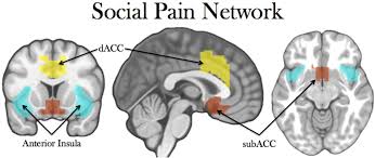In the human brain, the anterior cingulate cortex (acc) is the frontal part of the cingulate cortex that resembles a collar surrounding the frontal part of the corpus callosum. Figure 1 From Narcissists Social Pain Seen Only In The Brain Semantic Scholar