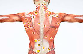 Serotonin sendromunun tedavi yöntemleri burada bulunabilir. Miyofasiyal Agri Sendromu Nedir Belirtileri Tedavisi Nadirfikir Com