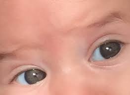 Meine kleine ist jetzt zwei wochen alt und hat noch blaue augen eigentlich muss sich die farbe noch ändern, denn sein vater und ich haben beide grüne augen. Augenfarbe Juni 2017 Babyclub Babycenter