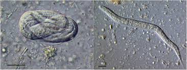 Image result for Strongyloides