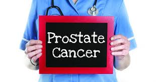 How common is prostate cancer? 1 In 9 Men Develop Prostate Cancer But If You Know This You Can Save Yourself