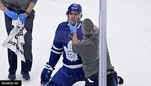Tavares left the game on a stretcher, giving a. John Tavares Injury Update What Happened To Toronto Maple Leafs Captain