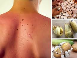 Namun ada juga tahi lalat yang membuat wajah jadi terlihat kurang cara menggunakannya: Tak Larat Tengok Tahi Lalat Di Tempat Tak Sepatutnya Buang Dengan Cara Ni Maskulin