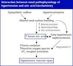 References In Uric Acid As An Independent Risk Factor In The Treatment Of Hypertension The Lancet