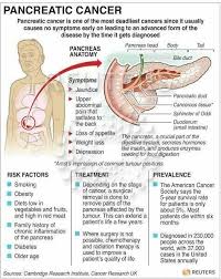 The sharp pain is usually felt in your upper abdomen and then radiates gradually toward your back. Pin On Healthcare Infographics