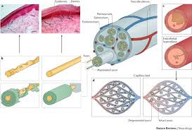 Schwann cell precursors as a cellular origin of melanocytes. Schwann Cell Interactions With Axons And Microvessels In Diabetic Neuropathy Nature Reviews Neurology