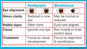 Image result for Strabismus