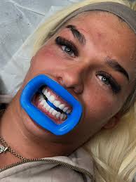 Are you looking for a confidence boost? 💎 Limited Time Offer 💎 Only £70  instead of £90 available for bookings made before 28/08. (Appointments can  take place after this date, but must