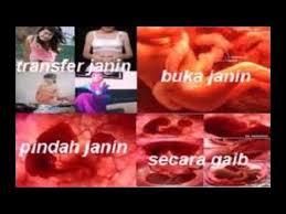 Anda hamil di luar nikah dan ditinggal pria yang menghamili jangan panik dan binggung, janin jangan di aborsi apalagi dengan pakai obat atau kuret,yang ada rahim luka atau. Dukun Transfer Janin Jarak Jauh Paling Ampuh Kyai Wali Songo Youtube