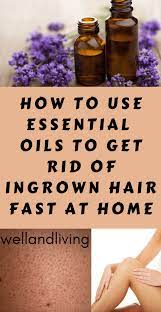 How To Use Essential Oils To Get Rid Of Ingrown Hair Fast At Home Well And Living Ingrown Hair Diy Ingrown Hair Treatment Oil Treatment For Hair