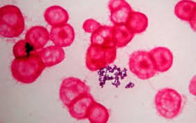 Image result for Corynebacterium