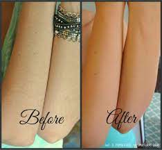 Arm Hair Removal For Women Rub A Remarkably Unexceptional Blog Arm Hair Hair Wax Wax Hair Removal