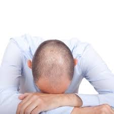 Hereditary hair loss with age is the most common cause of baldness. The Bald Facts About Losing Your Hair Health24