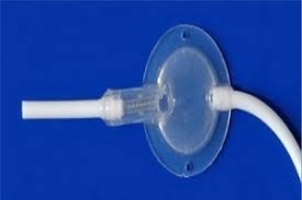 Chhabra Slit N Spring Hydrocephalus Shunt With Large Flushing Reservoir Anti Bacterial Vp