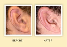 Just take it into the shower with you and clean it with running water. Hair Removal For Ears All Products Are Discounted Cheaper Than Retail Price Free Delivery Returns Off 64