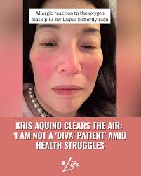 I AM NOT A DIVA PATIENT.' Kris Aquino has once again offered a glimpse into  her ongoing journey with multiple autoimmune diseases, taking to social  media to clarify misconceptions about her approach