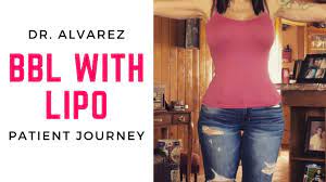 Mia aesthetics abdominal board was designed with wings to wrap around the waist for additional shaping of the abdomen. Patient Journeys Plastic Surgery At Mia Aesthetics