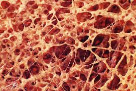 Translucence is an ivory characteristic that can be helpful in differentiating it from bone, as bone is an opaque substance. Newt Studios Bone Cross Section