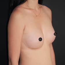 Really small tits
