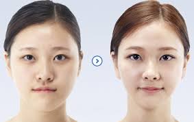 Image result for u-shape face