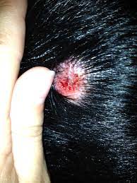 There are thousands of spiders around the whole world. My 2 Year Old Mn Doberman Has A Swollen Bump On His Left Shoulder Near Spine At First I Thought Is Was A Bite From