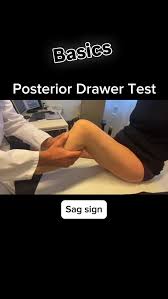 Image result for PCL Sag Test